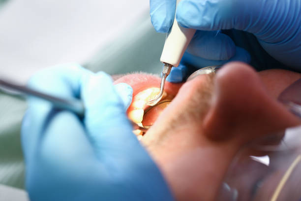 Best Emergency Gum Treatment in Athens, MI