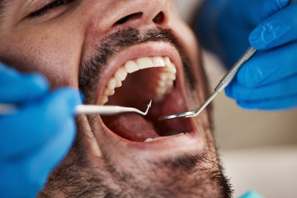 Best Cosmetic Emergency Dentistry in Athens, MI